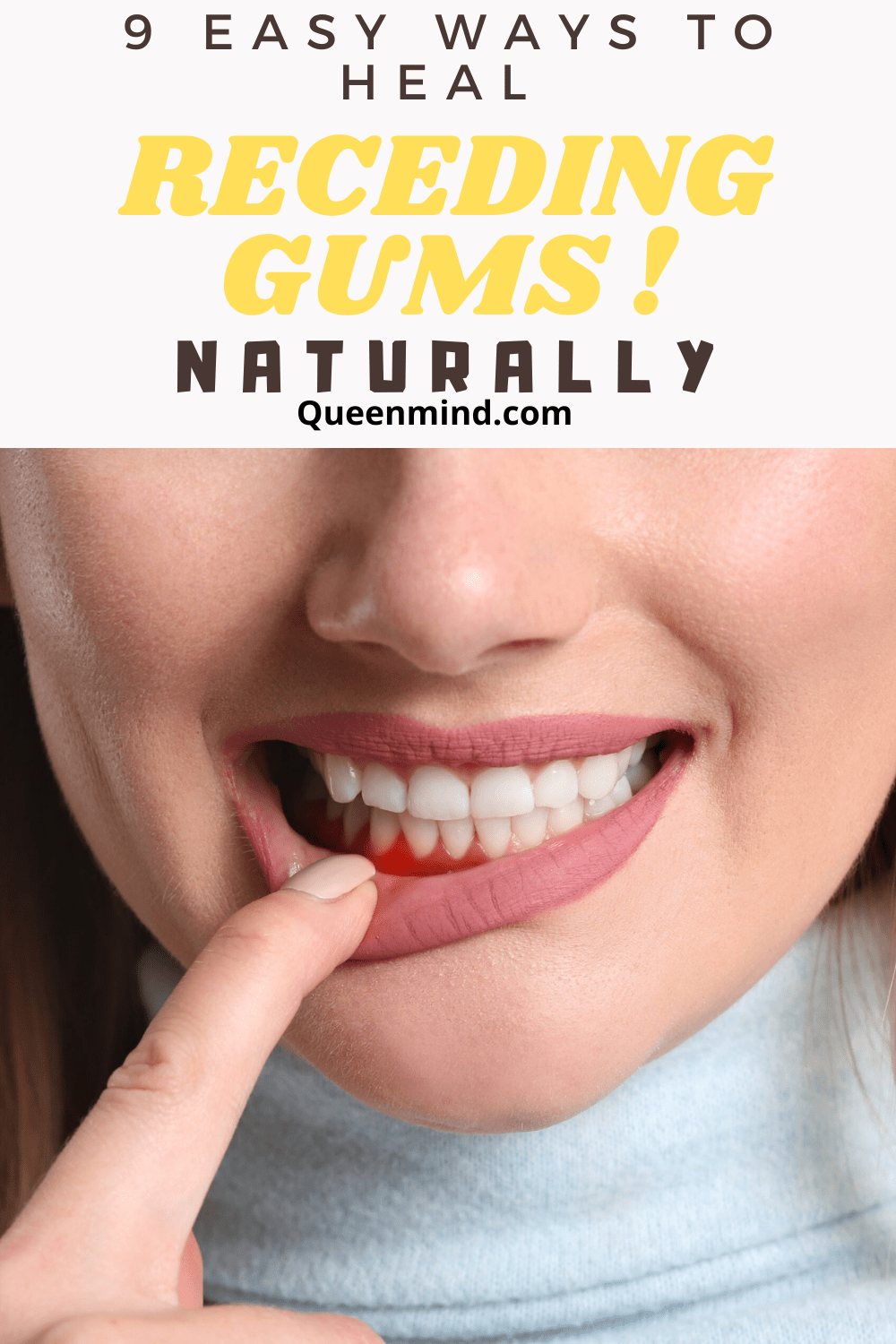 9 Easy Ways to Heal Receding Gums Naturally!
