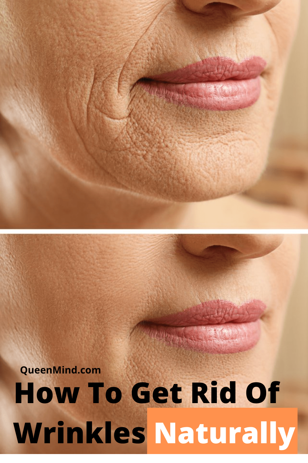 How To Get Rid Of Wrinkles Naturally