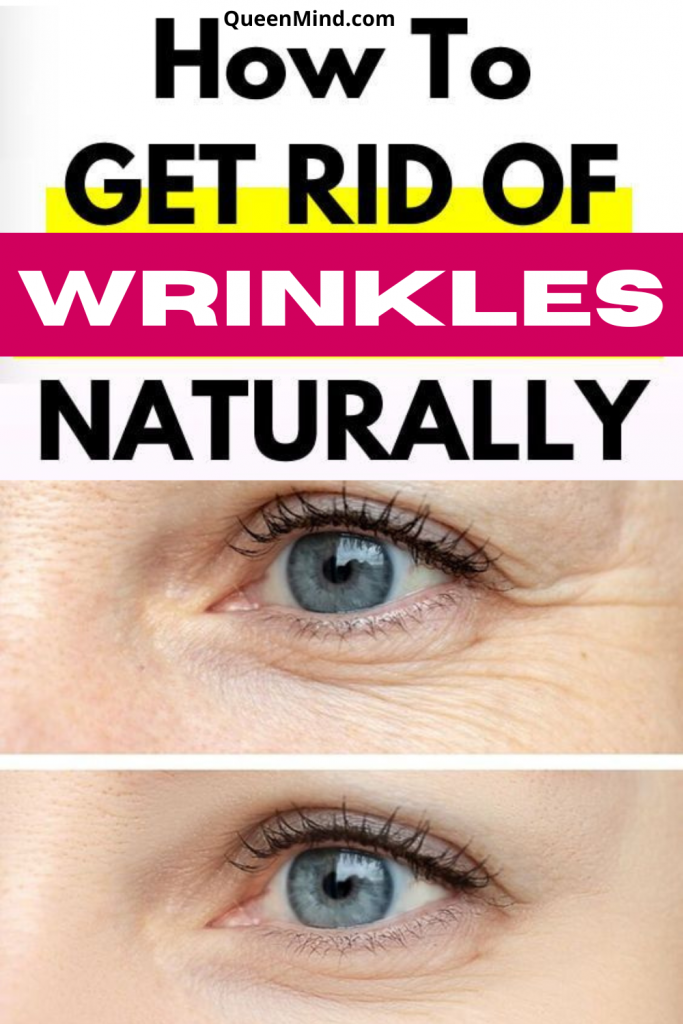 How To Get Rid Of Wrinkles Naturally QueenMind 3 683x1024 