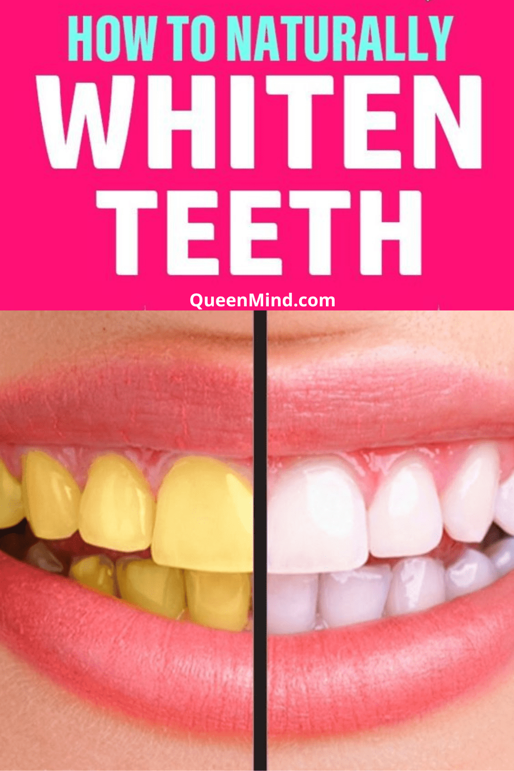 How to Get Whiter Teeth at Home Naturally