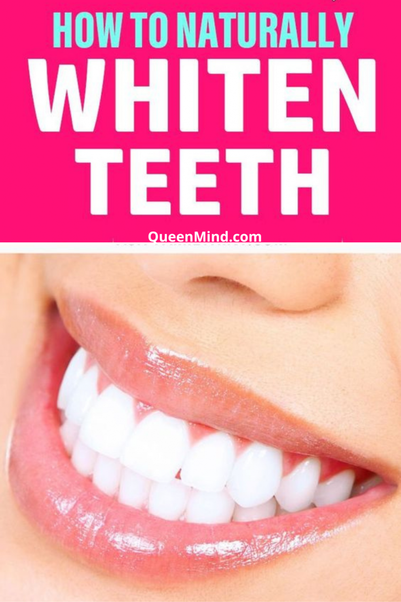 How to Get Whiter Teeth at Home Naturally - QueenMind