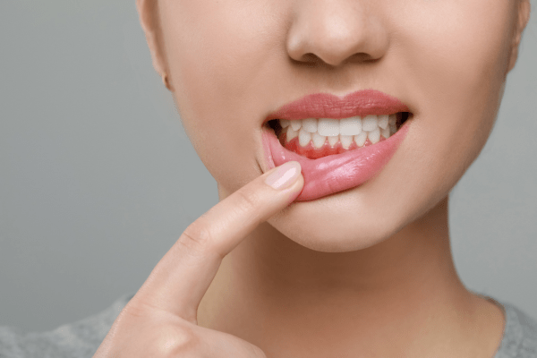 6 Powerful Ways to Regrow Receding Gums Naturally