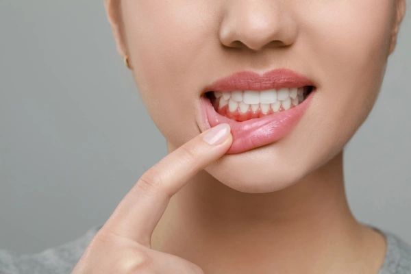 Clove Oil Paste for Gum Health