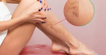 Essential Oils for Circulation