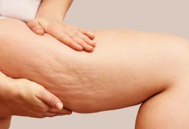 How to Use Coconut Oil to Reduce Cellulite